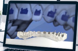 OrthoSelect Desktop Application